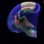 Mouse Brain Image with quantification